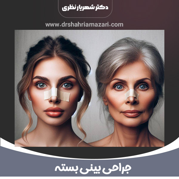 بهترین سن جراحی بینی