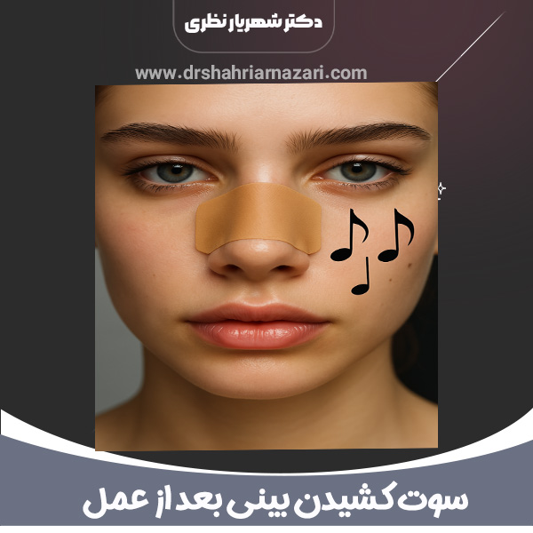 سوت کشیدن بینی بعد از عمل