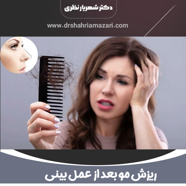 ریزش مو بعد از عمل بینی