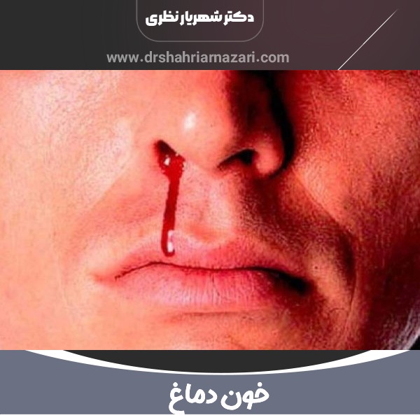 عکس خون دماغ خطرناک